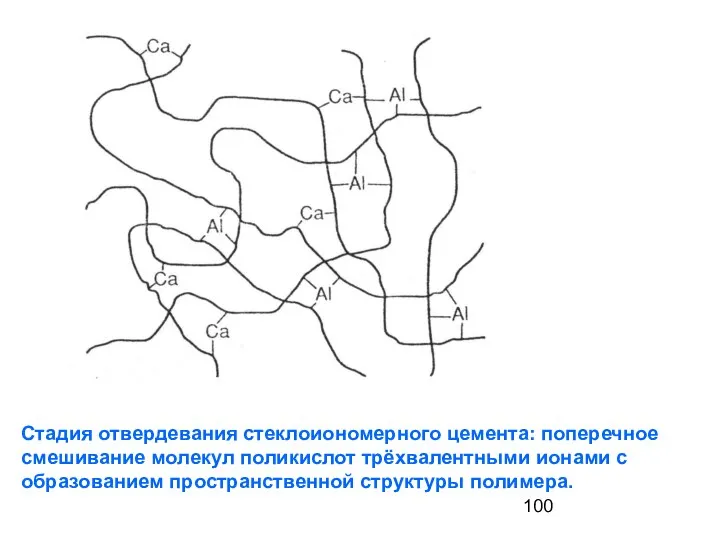 Стадия отвердевания стеклоиономерного цемента: поперечное смешивание молекул поликислот трёхвалентными ионами с образованием пространственной структуры полимера.