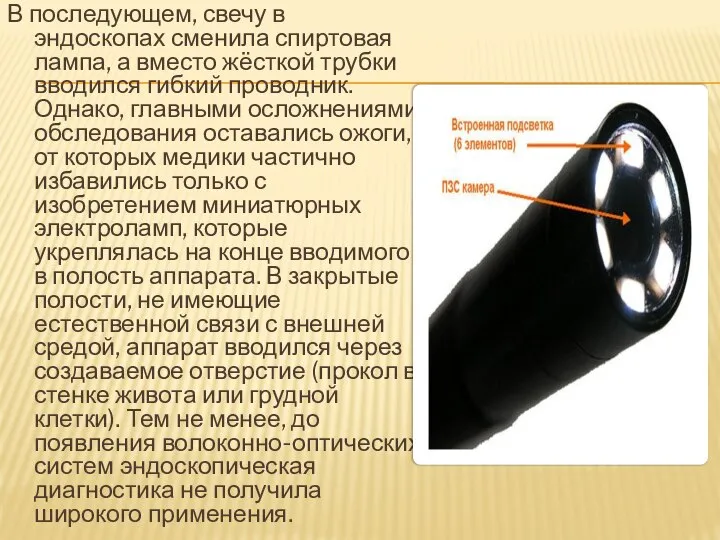 В последующем, свечу в эндоскопах сменила спиртовая лампа, а вместо жёсткой