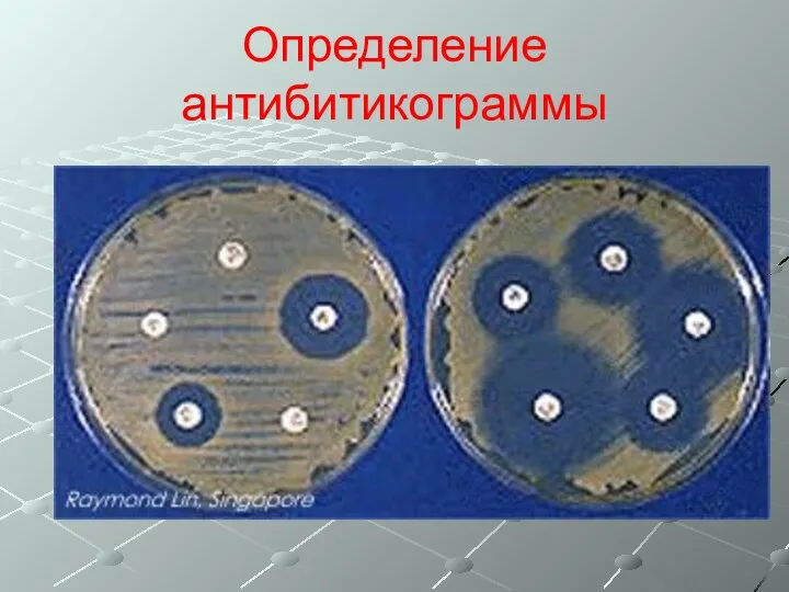 Определение антибитикограммы