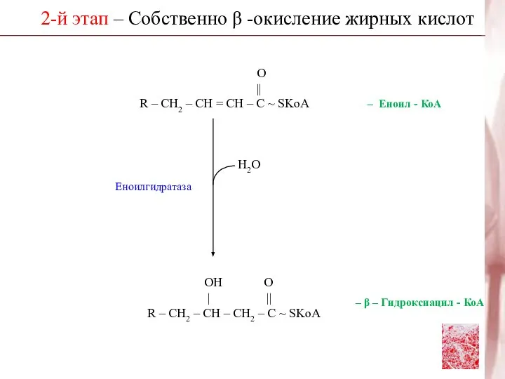 2-й этап – Собственно β -окисление жирных кислот Н2О ОН О