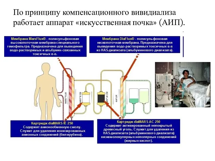 По принципу компенсационного вивидиализа работает аппарат «искусственная почка» (АИП).