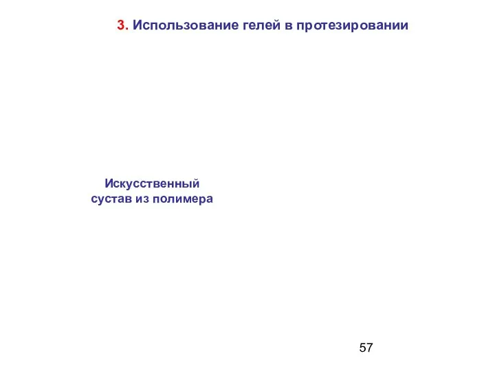 3. Использование гелей в протезировании Искусственный сустав из полимера