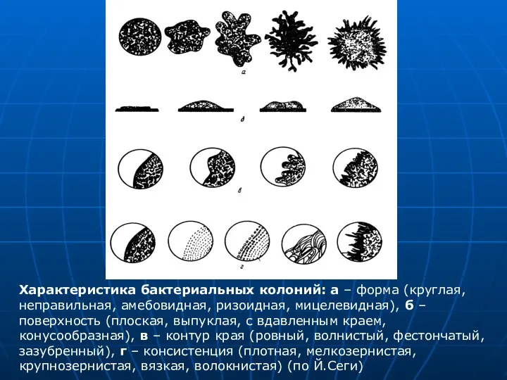 Характеристика бактериальных колоний: а – форма (круглая, неправильная, амебовидная, ризоидная, мицелевидная),