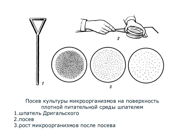 Посев культуры микроорганизмов на поверхность плотной питательной среды шпателем шпатель Дригальского посев рост микроорганизмов после посева