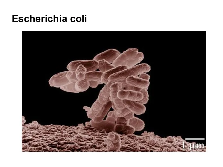 Escherichia coli