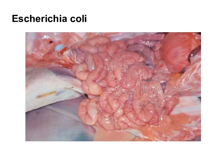 Escherichia coli