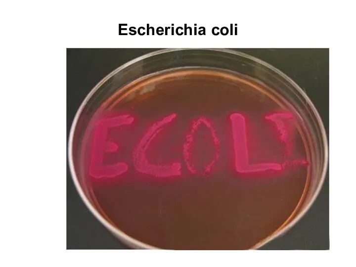 Escherichia coli