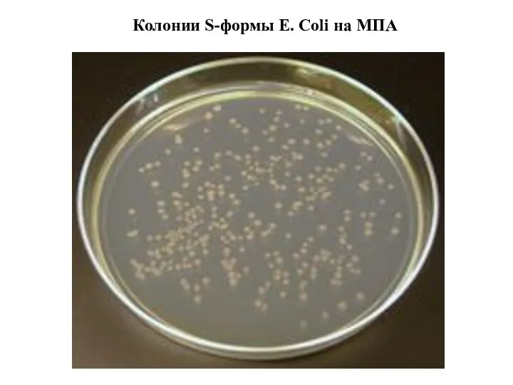 Колонии S-формы E. Coli на МПА