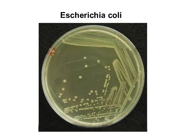 Escherichia coli