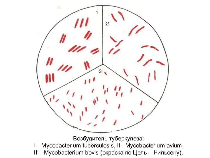 Возбудитель туберкулеза: I – Mycobacterium tuberculosis, II - Mycobacterium avium, III