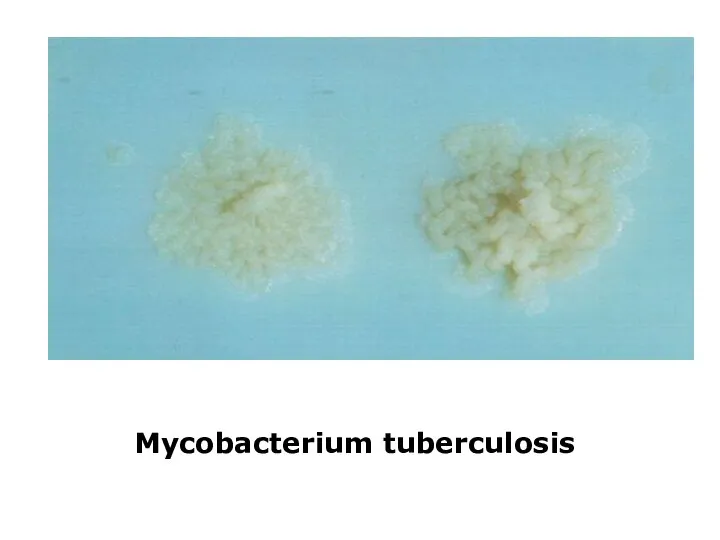 Mycobacterium tuberculosis