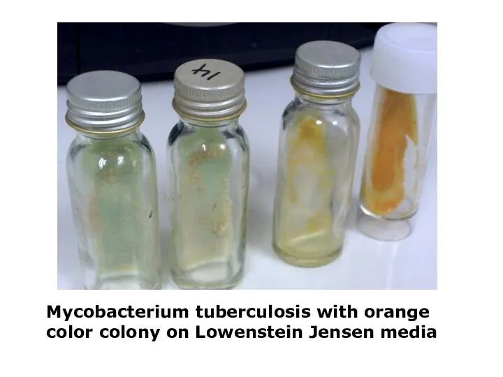 Mycobacterium tuberculosis with orange color colony on Lowenstein Jensen media