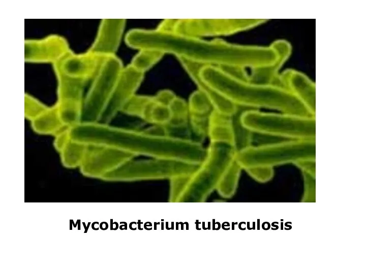 Mycobacterium tuberculosis