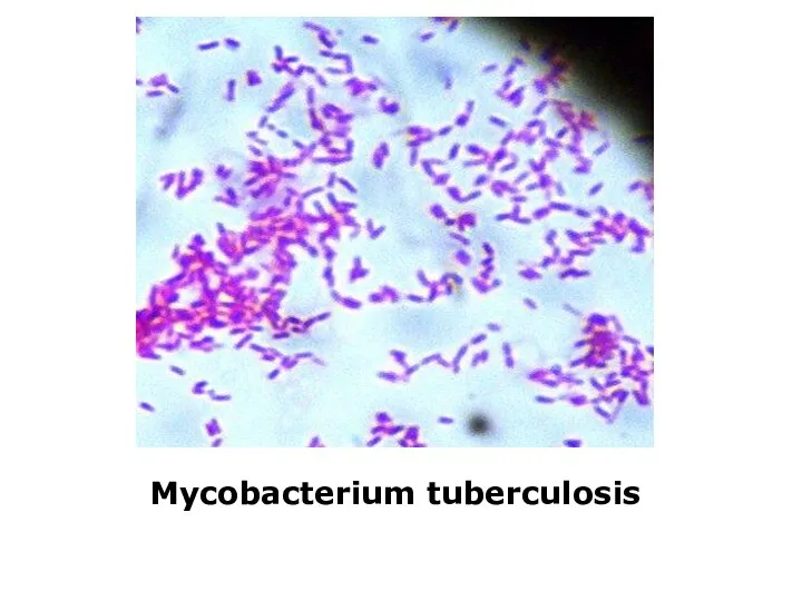 Mycobacterium tuberculosis