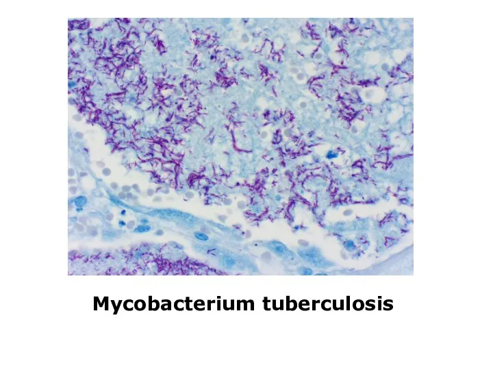 Mycobacterium tuberculosis