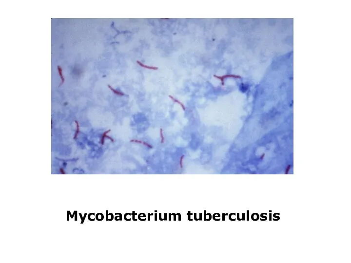 Mycobacterium tuberculosis