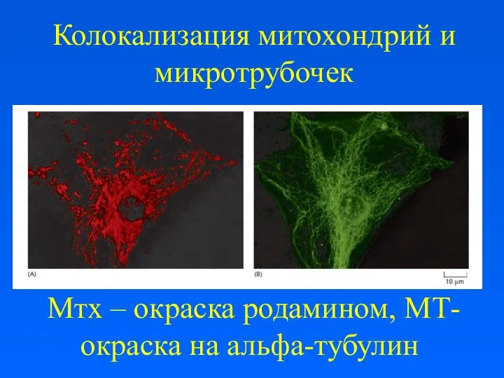 Колокализация митохондрий и микротрубочек Мтх – окраска родамином, МТ- окраска на альфа-тубулин