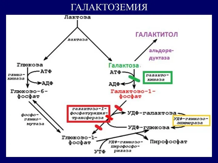 ГАЛАКТОЗЕМИЯ