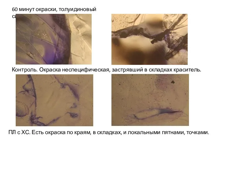 60 минут окраски, толуидиновый синий Контроль. Окраска неспецифическая, застрявший в складках