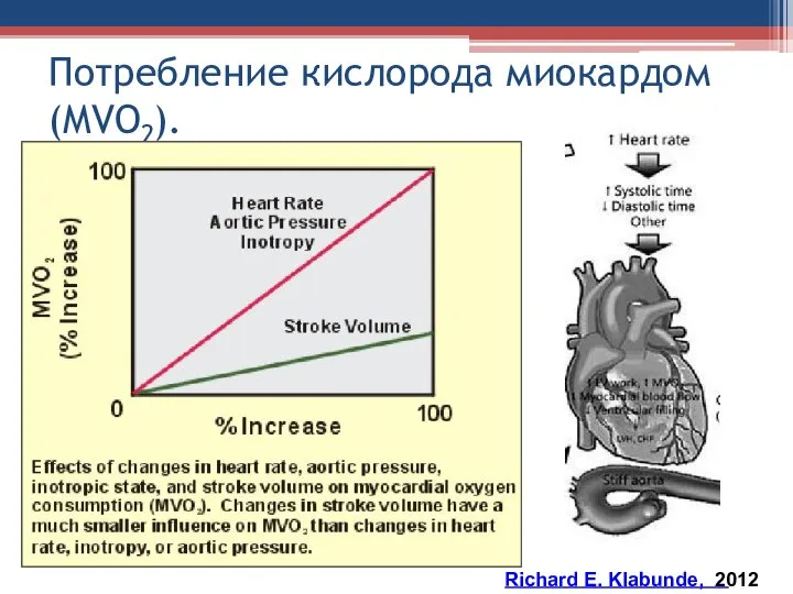 Потребление кислорода миокардом (MVO ). 2 Richard E. Klabunde, 2012