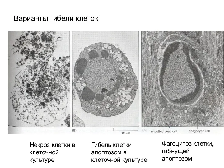 Варианты гибели клеток Некроз клетки в клеточной культуре Гибель клетки апоптозом