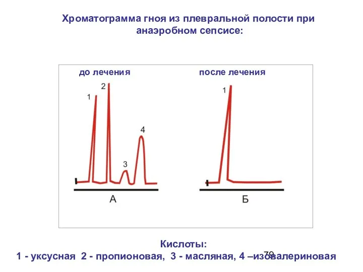 до лечения после лечения Хроматограмма гноя из плевральной полости при анаэробном