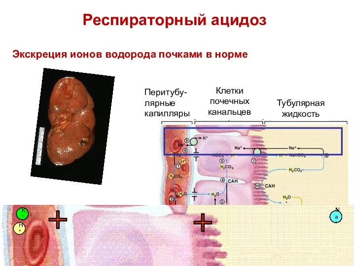 Экскреция ионов водорода почками в норме K+ K+ K+ K+ K+