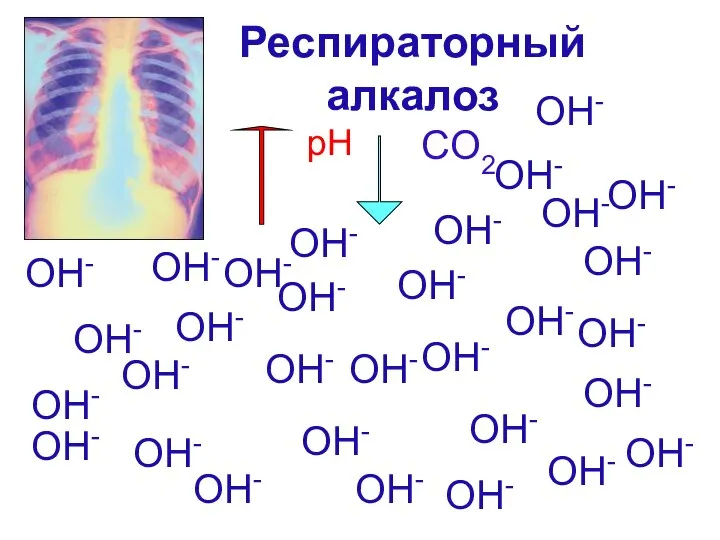 Респираторный алкалоз OH- OH- OH- OH- OH- OH- OH- OH- OH-