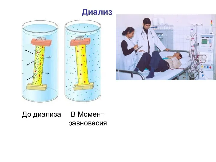 Диализ До диализа В Момент равновесия