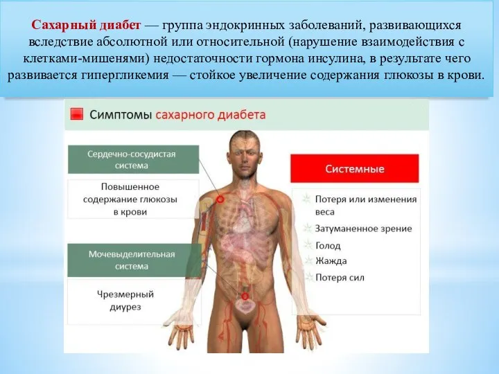 Сахарный диабет — группа эндокринных заболеваний, развивающихся вследствие абсолютной или относительной