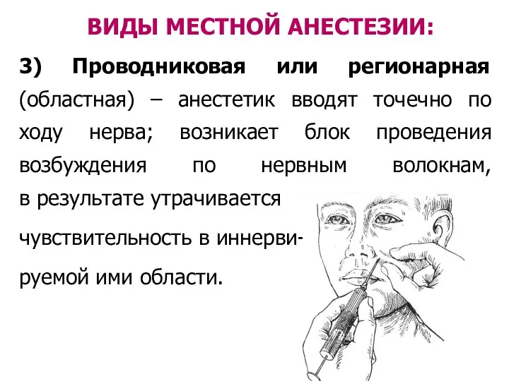 3) Проводниковая или регионарная (областная) – анестетик вводят точечно по ходу