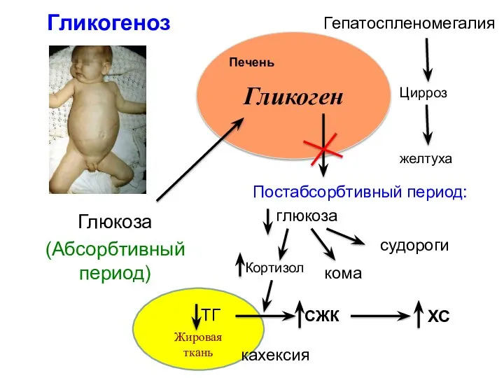 Жировая ткань Глюкоза (Абсорбтивный период) Гликоген Печень Гликогеноз Постабсорбтивный период: глюкоза