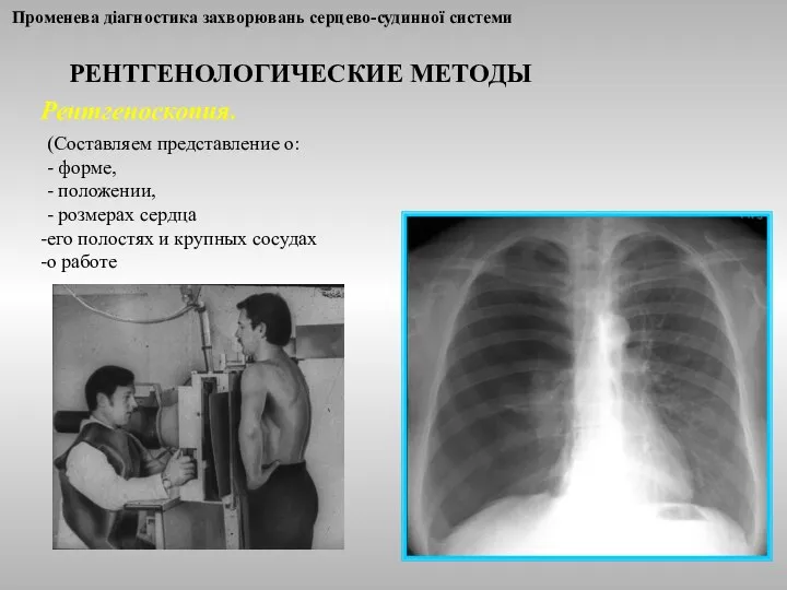 Променева діагностика захворювань серцево-судинної системи РЕНТГЕНОЛОГИЧЕСКИЕ МЕТОДЫ Рентгеноскопия. (Составляем представление о: