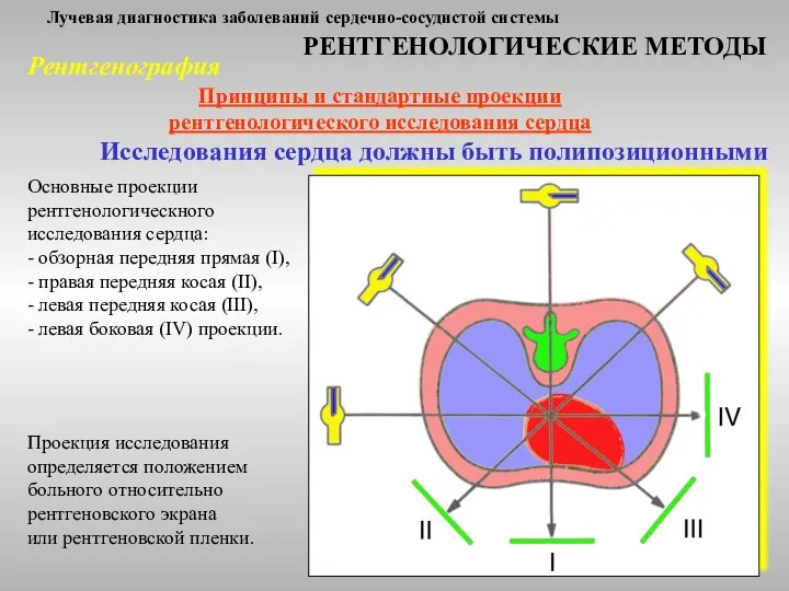 Лучевая диагностика заболеваний сердечно-сосудистой системы РЕНТГЕНОЛОГИЧЕСКИЕ МЕТОДЫ Принципы и стандартные проекции