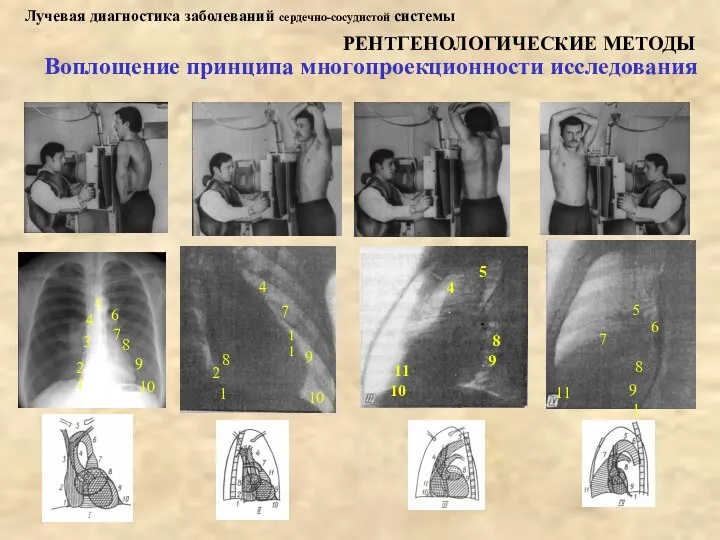 Лучевая диагностика заболеваний сердечно-сосудистой системы РЕНТГЕНОЛОГИЧЕСКИЕ МЕТОДЫ Воплощение принципа многопроекционности исследования