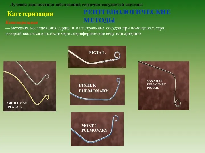 Лучевая диагностика заболеваний сердечно-сосудистой системы РЕНТГЕНОЛОГИЧЕСКИЕ МЕТОДЫ Катетеризация Катетеризация — методика