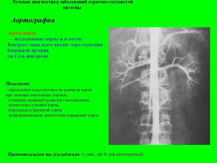 Лучевая диагностика заболеваний сердечно-сосудистой системы Аортография Аортография — исследование аорты и
