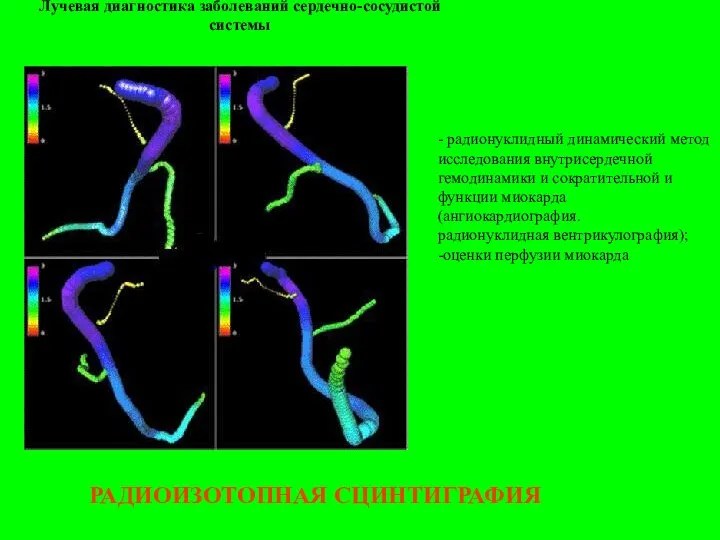 Лучевая диагностика заболеваний сердечно-сосудистой системы РАДИОИЗОТОПНАЯ СЦИНТИГРАФИЯ - радионуклидный динамический метод