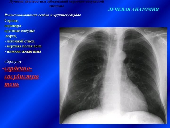 Лучевая диагностика заболеваний сердечно-сосудистой системы ЛУЧЕВАЯ АНАТОМИЯ Рентгеноанатомия сердца и крупных