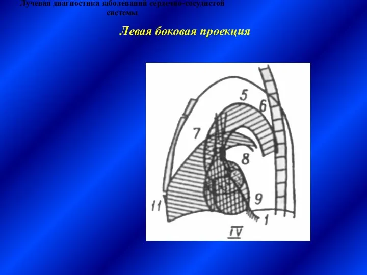 Лучевая диагностика заболеваний сердечно-сосудистой системы Левая боковая проекция