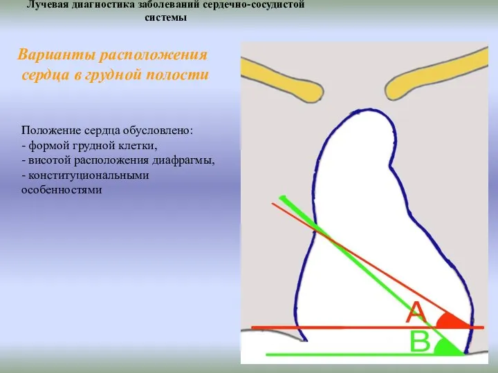 Лучевая диагностика заболеваний сердечно-сосудистой системы Положение сердца обусловлено: - формой грудной