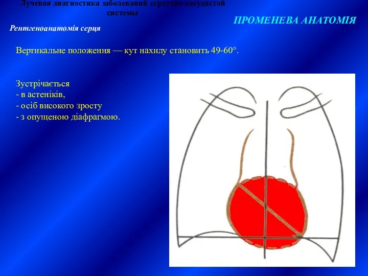 Лучевая диагностика заболеваний сердечно-сосудистой системы ПРОМЕНЕВА АНАТОМІЯ Рентгеноанатомія серця Вертикальне положення