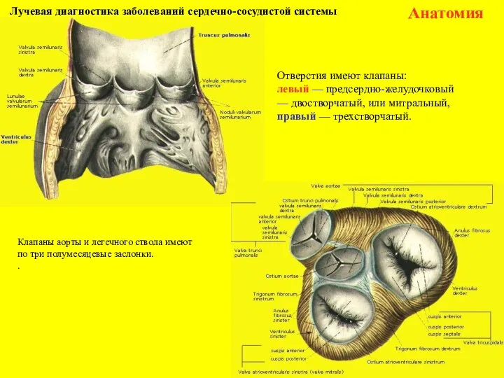 Лучевая диагностика заболеваний сердечно-сосудистой системы Анатомия Клапаны аорты и легечного ствола