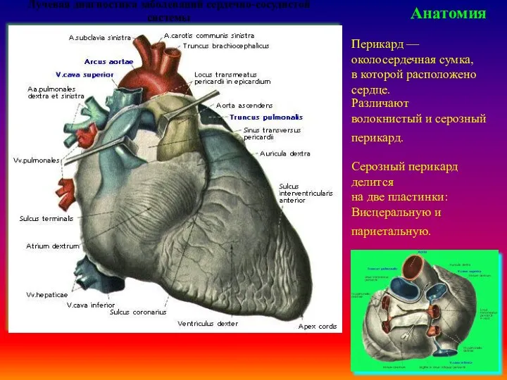 Лучевая диагностика заболеваний сердечно-сосудистой системы Анатомия Перикард — околосердечная сумка, в