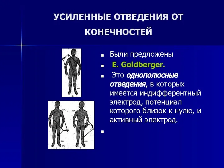 УСИЛЕННЫЕ ОТВЕДЕНИЯ ОТ КОНЕЧНОСТЕЙ Были предложены E. Goldberger. Это однополюсные отведения,