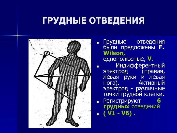 ГРУДНЫЕ ОТВЕДЕНИЯ Грудные отведения были предложены F. Wilson, однополюсные, V. Индифферентный