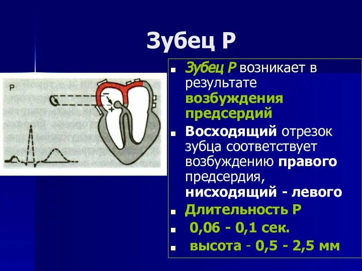 Зубец Р Зубец Р возникает в результате возбуждения предсердий Восходящий отрезок