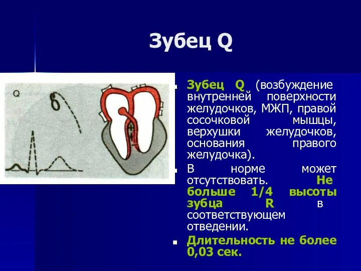 Зубец Q Зубец Q (возбуждение внутренней поверхности желудочков, МЖП, правой сосочковой