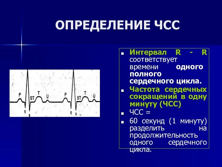 ОПРЕДЕЛЕНИЕ ЧСС Интервал R - R соответствует времени одного полного сердечного