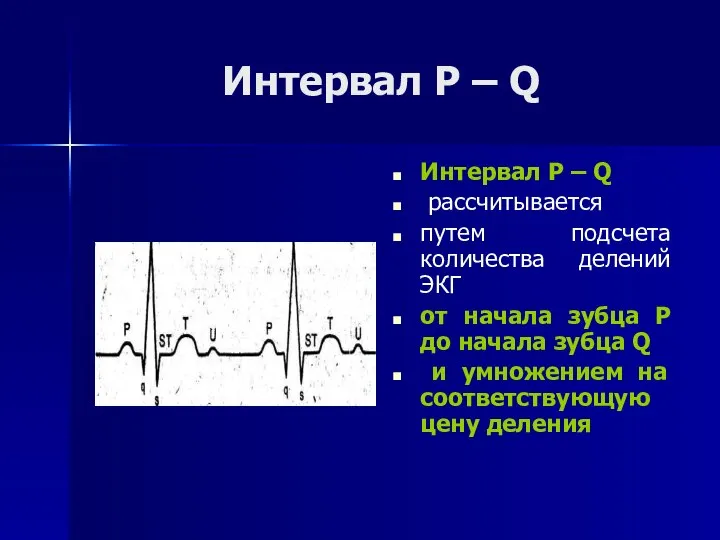 Интервал Р – Q Интервал Р – Q рассчитывается путем подсчета